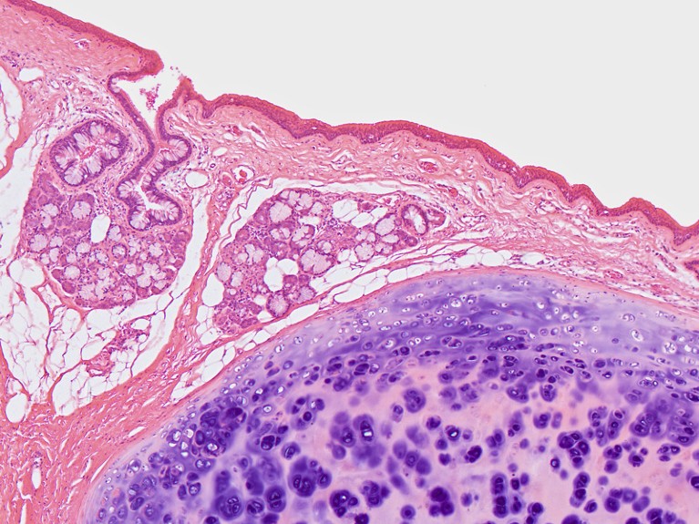 Micrograph of a section of human tissue, stained pink and purple.