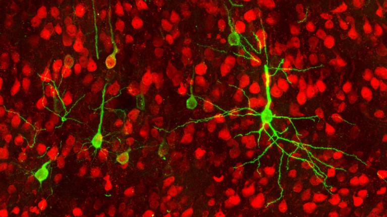 Rabies-virus-labeled neurons (green) in the insula that send projections down to the stomach.