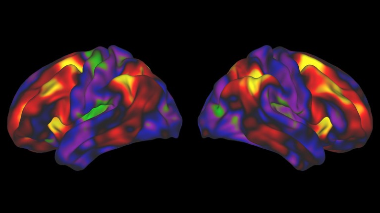 Two coloured images of a brain on a black background.