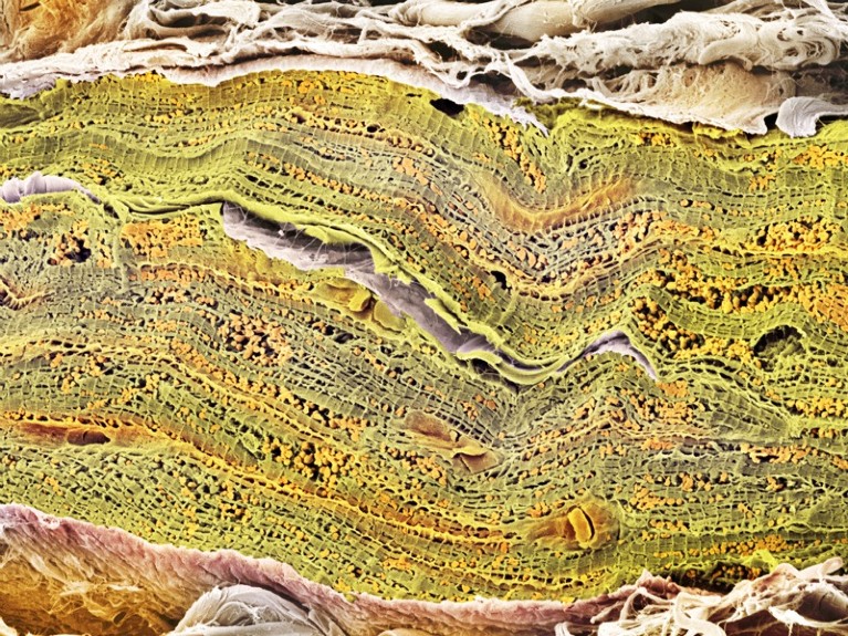 Cardiac muscle. Coloured scanning electron micrograph (SEM) of a bundle of cardiac muscle fibrils (green) from a healthy heart.