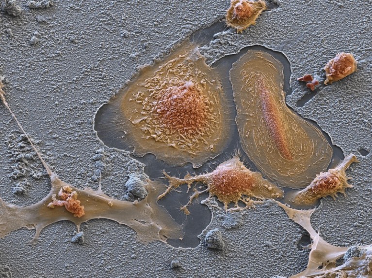 Coloured scanning electron micrograph (SEM) of cultured osteoclasts (orange).