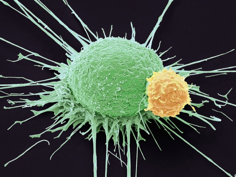 T lymphocyte and cancer cell, SEM.