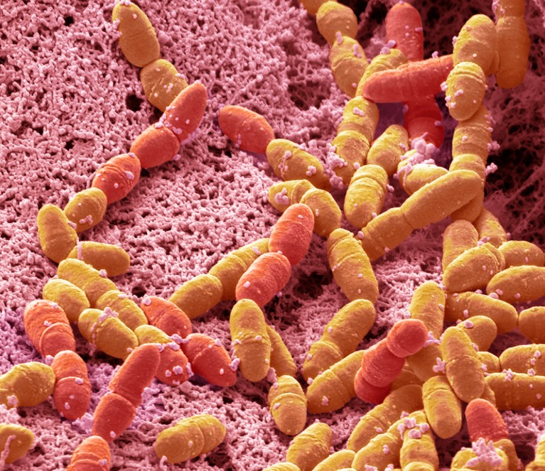 Coloured scanning electron micrograph of Streptococcus mutans