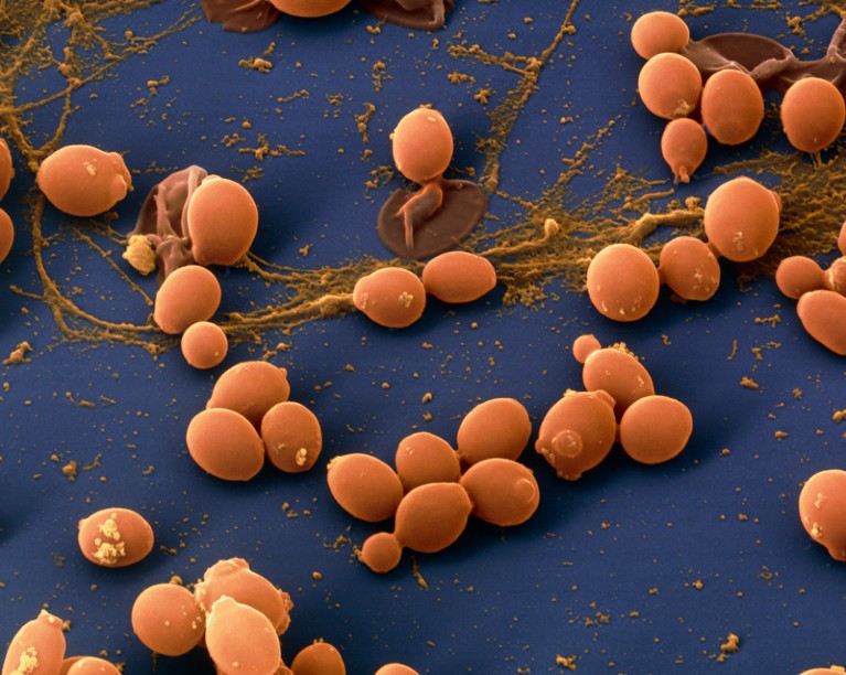 Coloured Scanning Electron Micrograph of the fungus Candida albicans