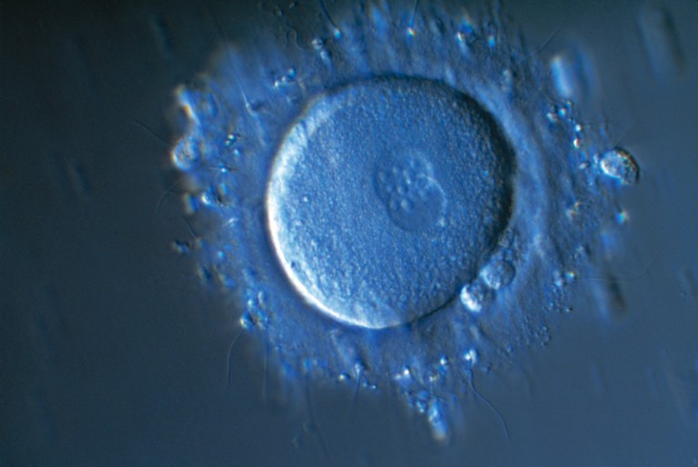 Light micrograph of a human egg cell during fertilisation