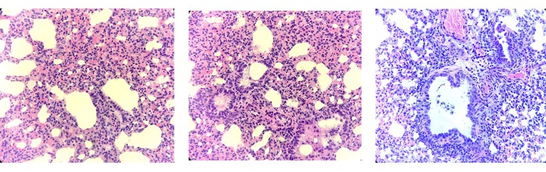 Damaged tissue of SARS-CoV-2 CMA3p20 infection in mice
