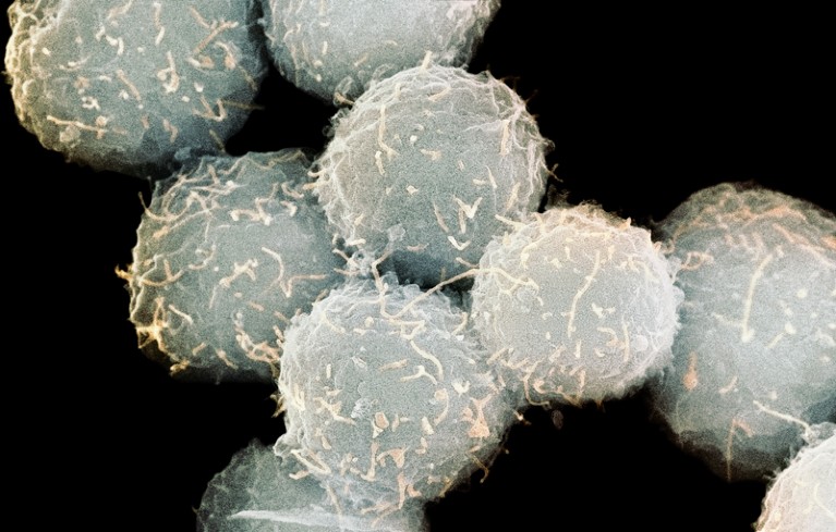 Coloured scanning electron micrograph of stem cells