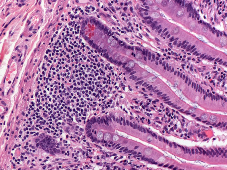 Light micrograph of the jejunum showing paneth cells