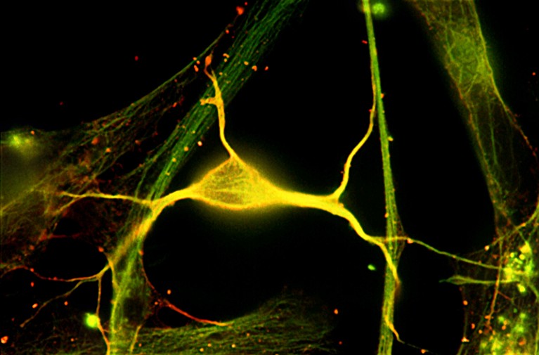 Fluorescent micrograph of a neuron from the hippocampus