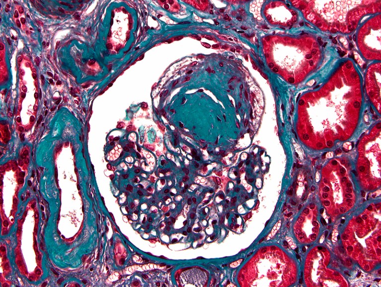 Light micrograph of a section through a kidney.