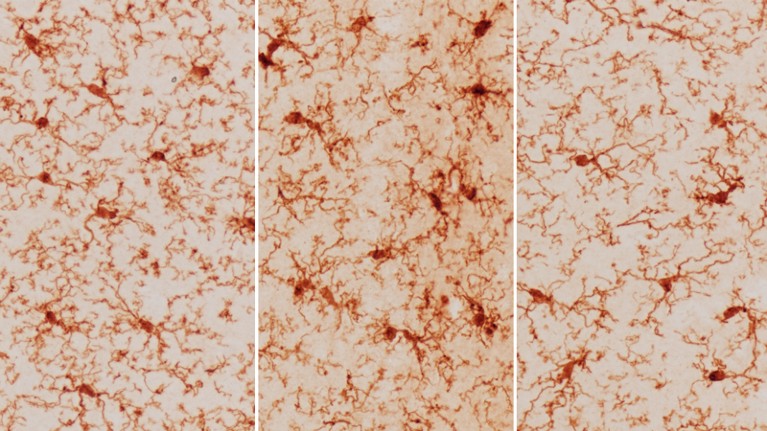 Three micrographs showing the microglia in various mouse brains.