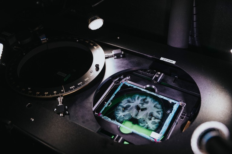 A very thin slice of a human brain between glass slides is loaded into a special microscope for imaging brain nerve fibres