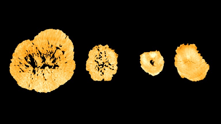 Examples of NMC particle cross sections from the recycled sample and the control sample