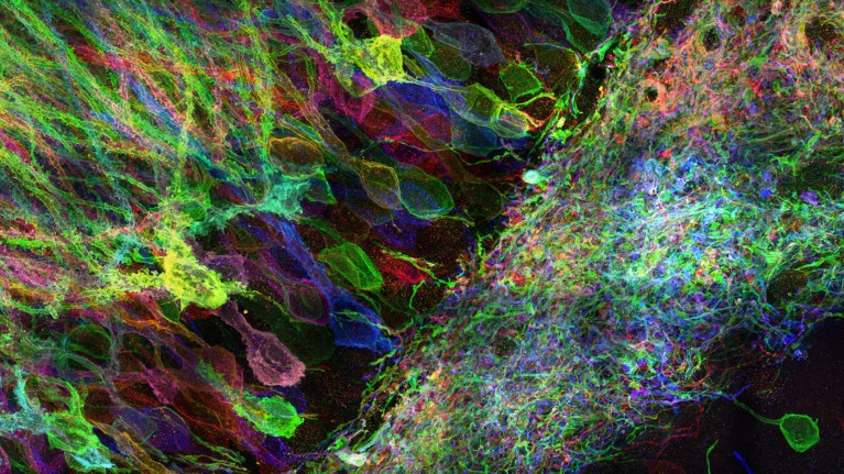 Confocal micrograph of neurons in a macaque brain labelled with different colours