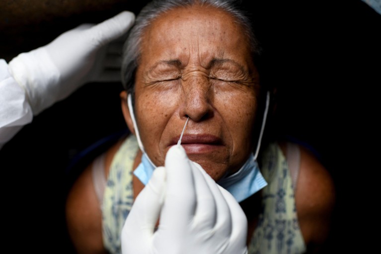 A woman has her nose swabbed as part of a test for COVID-10 infection in Brazil