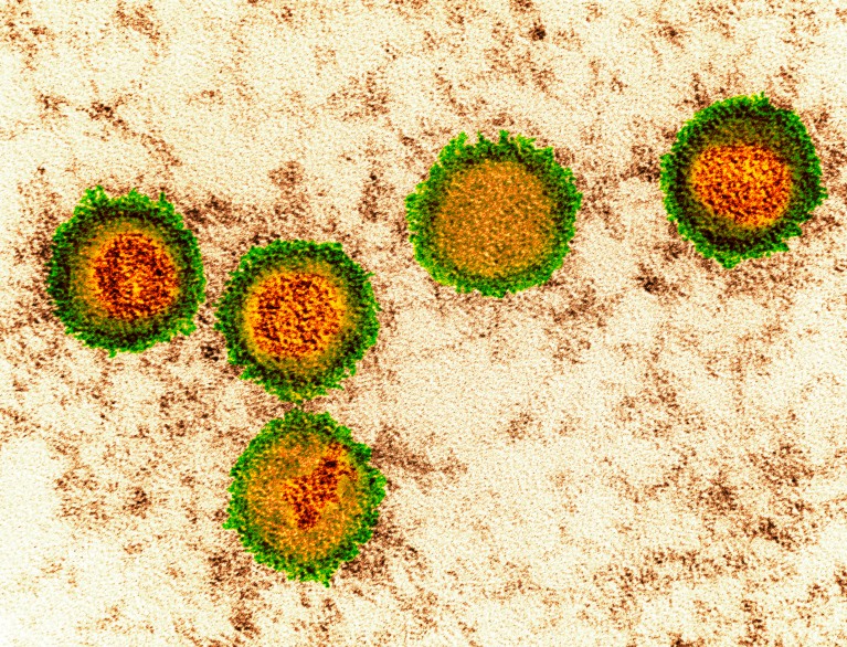 False coloured transmission electron micrograph of Epstein-Barr virus