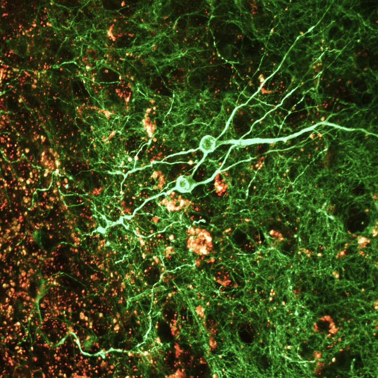 Confocal light micrograph of a section through the hippocampus of the human brain showing neurons in green fluorescent.
