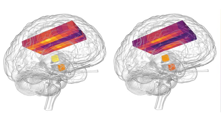 Illustration of the temperature of the afternoon female brain (left), and temperature of the afternoon male brain (right).