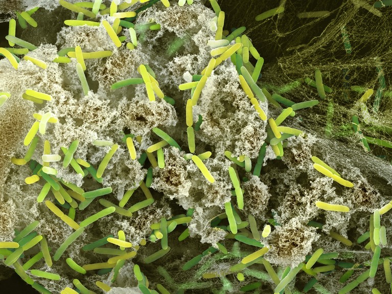 Coloured scanning electron micrograph (SEM) of Gram-negative rod-shaped Pseudomonas aeruginosa bacteria.