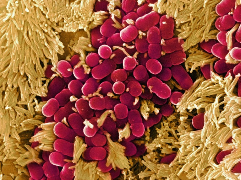 Coloured scanning electron micrograph (SEM) of Escherichia coli bacteria (red) taken from the small intestine of a child.
