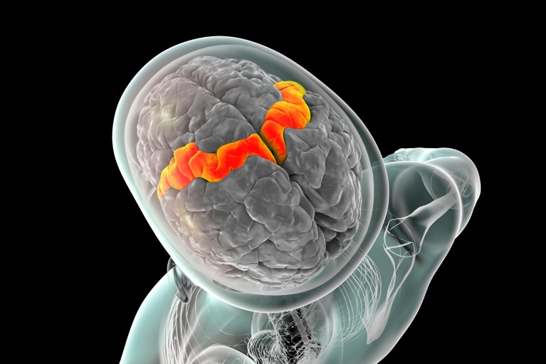 Computer illustration of the human brain inside the body with the precentral gyrus highlighted in orange