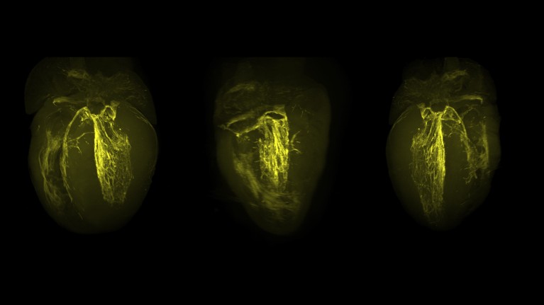 Three images of a tissue-cleared heart showing near-infrared signal in yellow on a black background