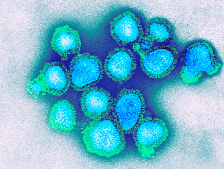 Coloured transmission electron micrograph of H3N2 influenza virus particles