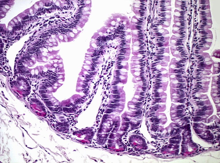 Light micrograph of the jejunum showing paneth cells