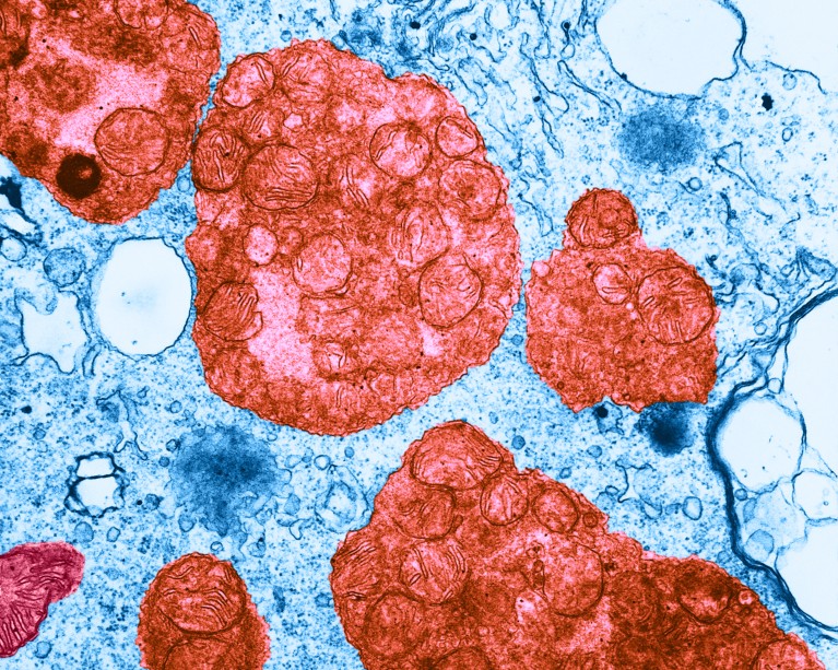 Red and blue colour-enhanced transmission electron micrograph showing lysosomes.