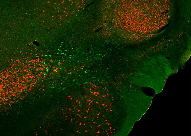 Red and green dots reveal neurons and protein expression of a chemical messenger in a brain slice of the rat thalamus.