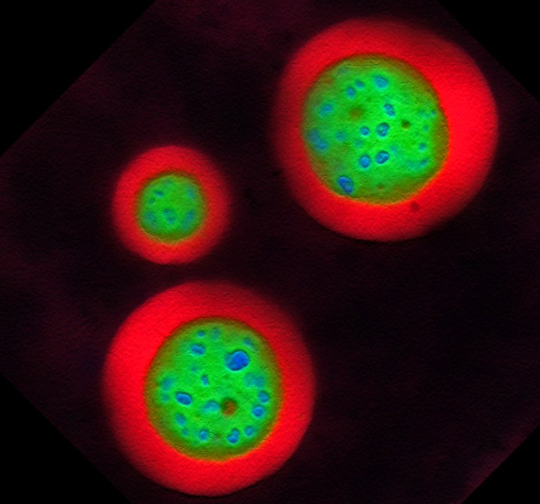 Nucleoli from oocytes of the frog Xenopus laevis.
