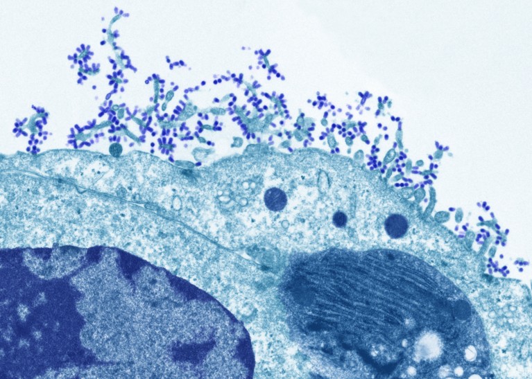 Coloured transmission electron micrograph of human cells infected with influenza virus