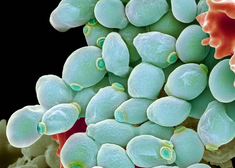 Coloured scanning electron micrograph of Candida albicans yeast cells