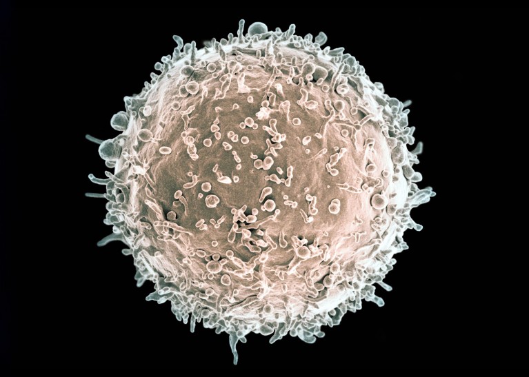 Coloured scanning electron microscope of a human B-lymphocyte