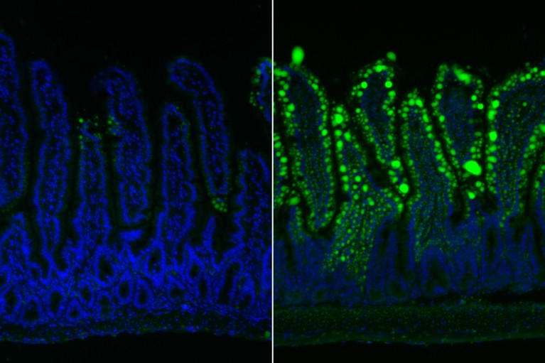 A composite of two images showing the fat absorption in the intestines of a mouse - this is shown in green