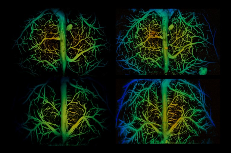 A composite of four images on a black background showing a mouse brain vasculature.