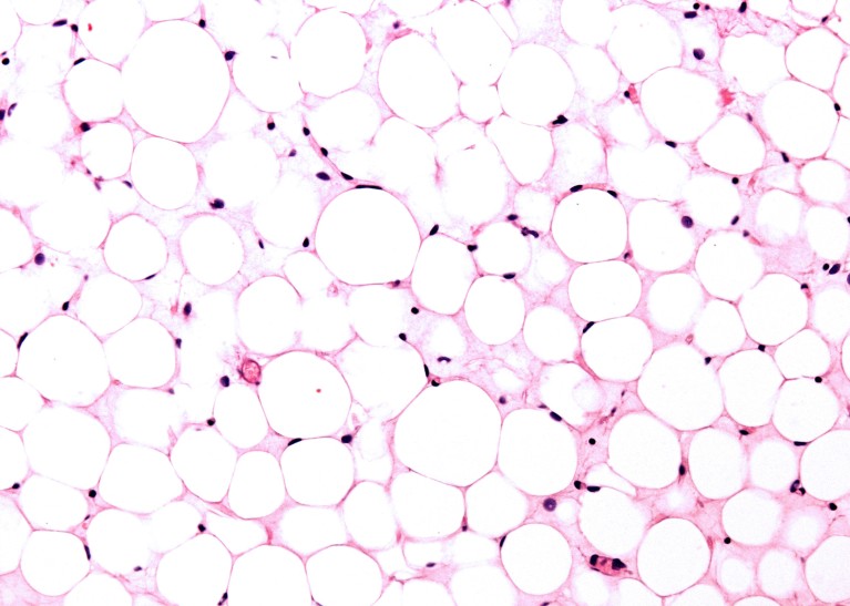 Light micrograph of white adipose tissue stained with haematoxylin and eosin