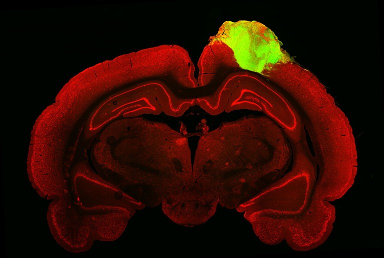 A rat brain with a grafted human brain organoid shown in red and green on a black background