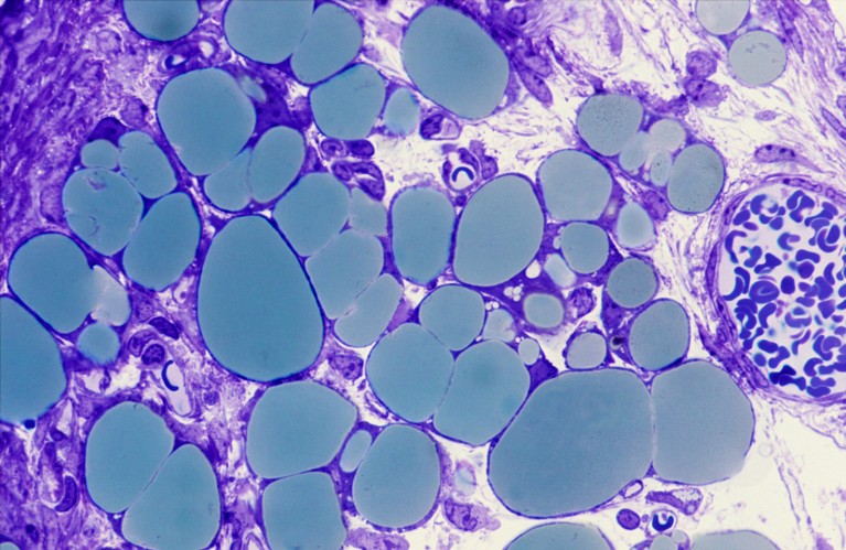 人类脂肪细胞的光学显微镜图像