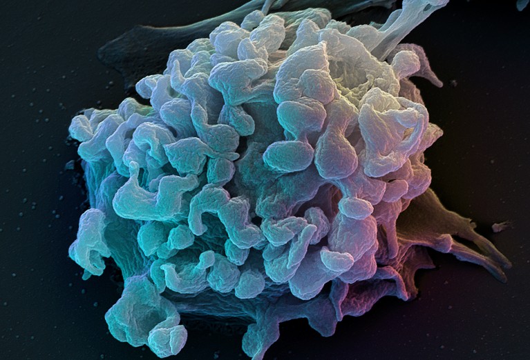 Coloured scanning electron micrograph (SEM) of a T-lymphocyte.