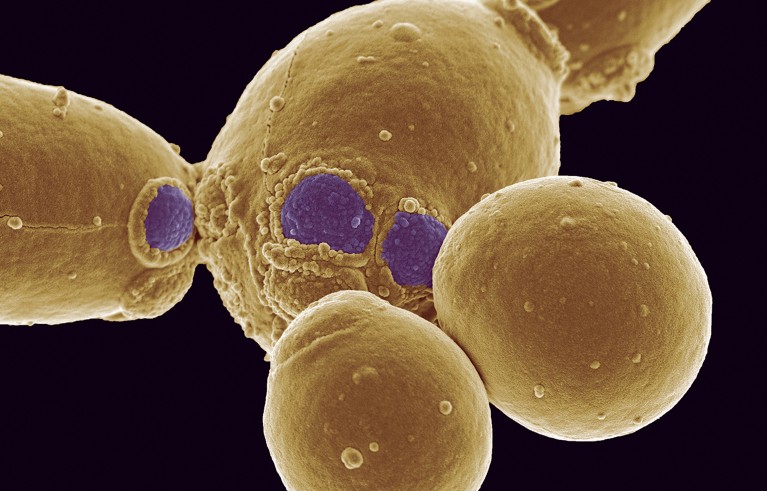Colour enhanced scanning electron micrograph (SEM) of the yeast-like fungus Candida albicans, a cause of thrush (candidiasis).