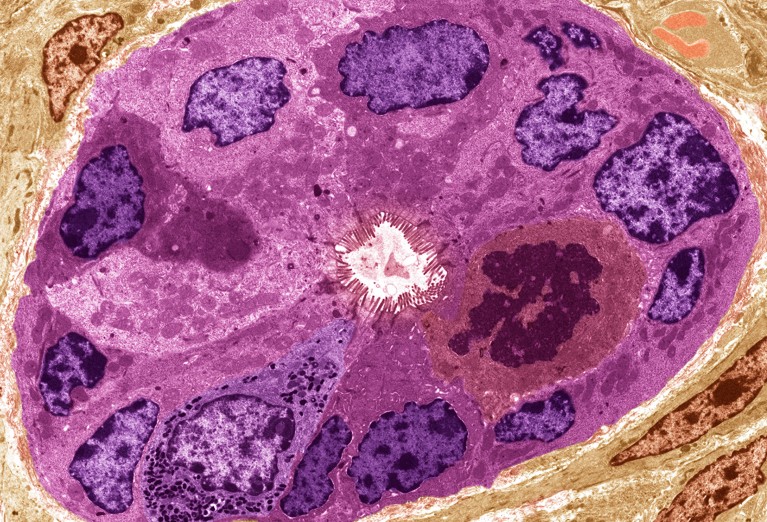 Coloured transmission electron micrograph (TEM) of a section through an intestinal gland of the small gut.
