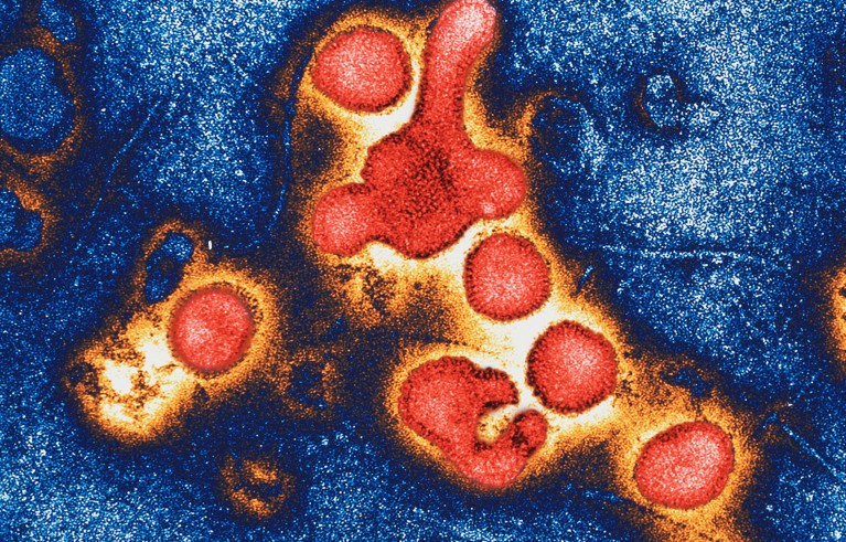 甲型流感病毒,TEM图像。
