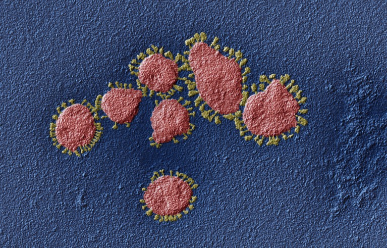 彩色扫描电子显微摄影(SEM)集群的冠状病毒粒子。