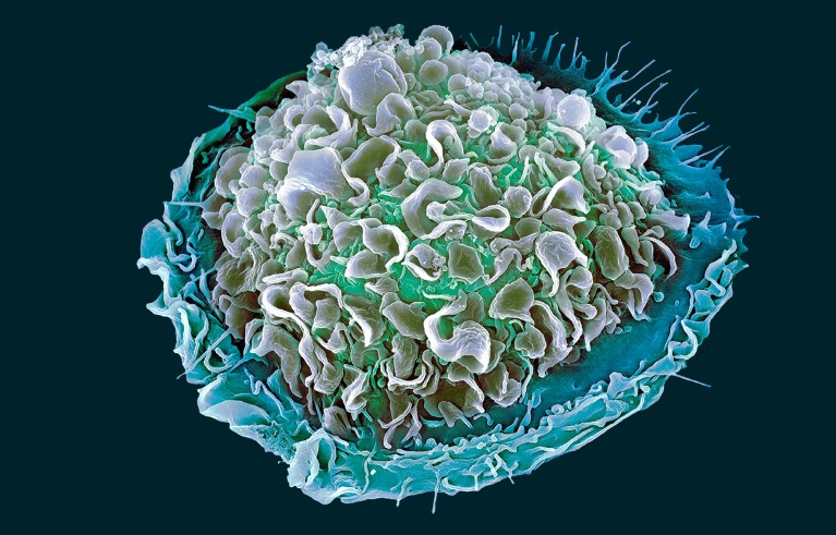 Coloured scanning electron micrograph (SEM) of a human macrophage white blood cell.
