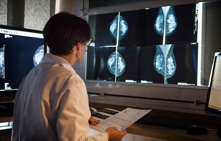 A radiologist looks at the results of mammograms.