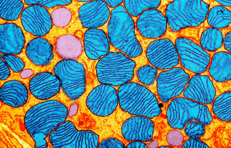 Transmission electron microscopy image showing mitochondria (coloured blue).