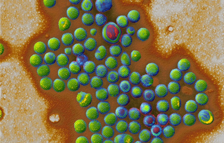 Coloured transmission electron micrograph of a cluster of rotaviruses.