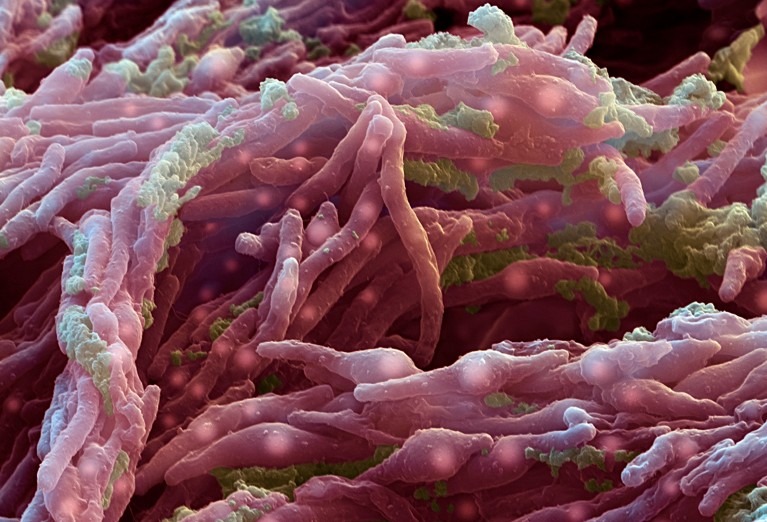 Coloured scanning electron micrograph (SEM) of Mycobacterium tuberculosis bacteria (red).