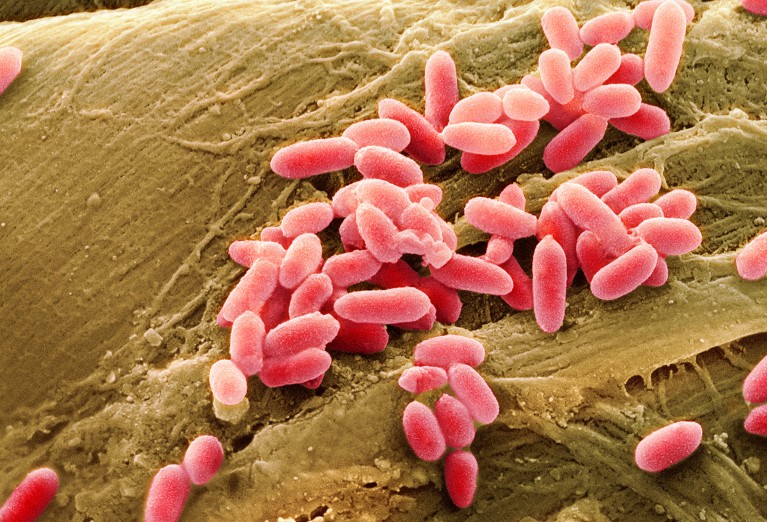 Pseudomonas aeruginosa bacteria, coloured scanning electron micrograph (SEM).